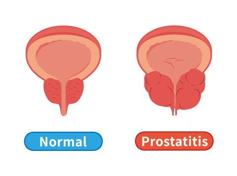 ProstaNatur Plus