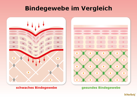 Silicium Mangan Bambus Ermäßigte Mehrwertsteuer Dr. Peter Hartig
